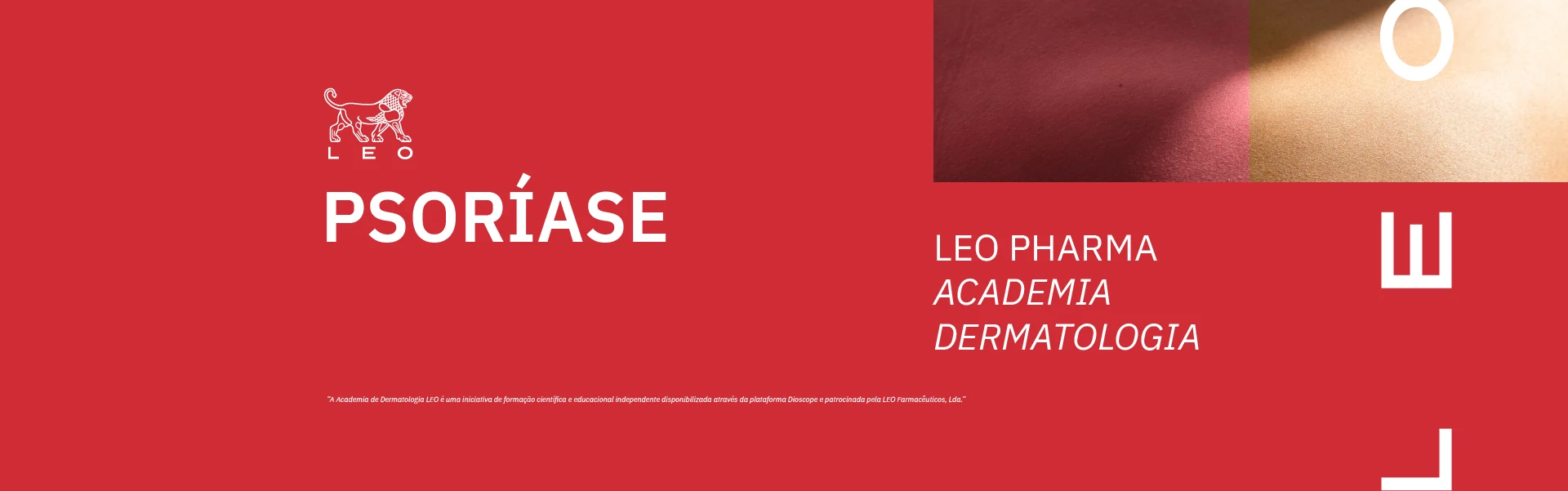 Psor&iacute;ase - LEO Pharma Academia Dermatologia