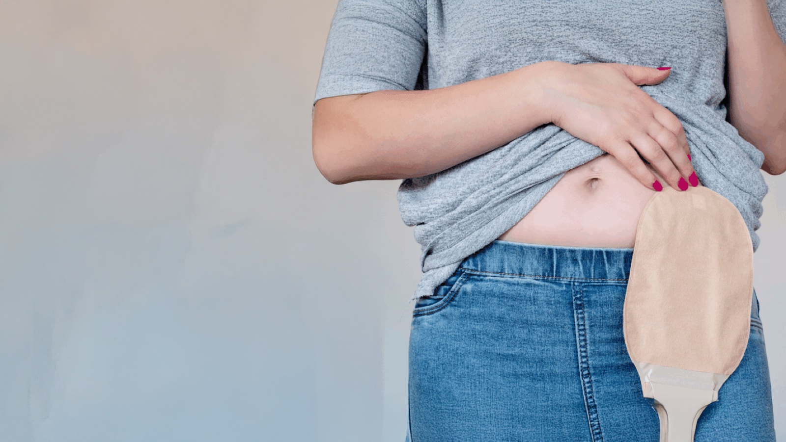 Imagem do curso Cuidar para viver melhor: ostomias de elimina&ccedil;&atilde;o, alimenta&ccedil;&atilde;o e respirat&oacute;rias